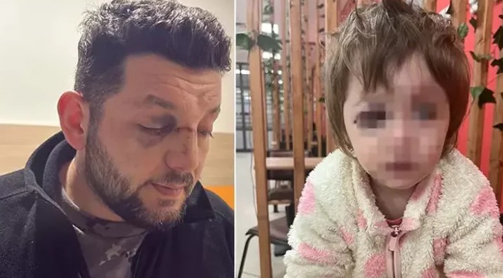 Komşu Kavgasında Bebek Yaralandı: Saldırgan 36 Yıl Yatabilir Komşu Kavgasında Bebek Yaralandı Adam 36 Yıl Yatabilir